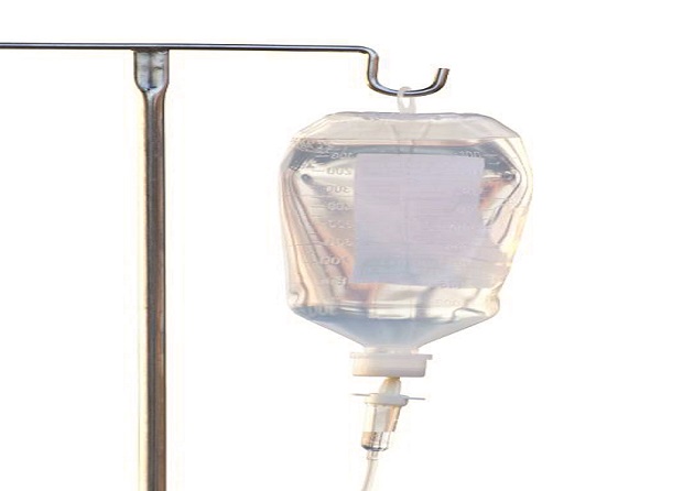 Fibromyalgia & Intravenous Lidocaine Infusion